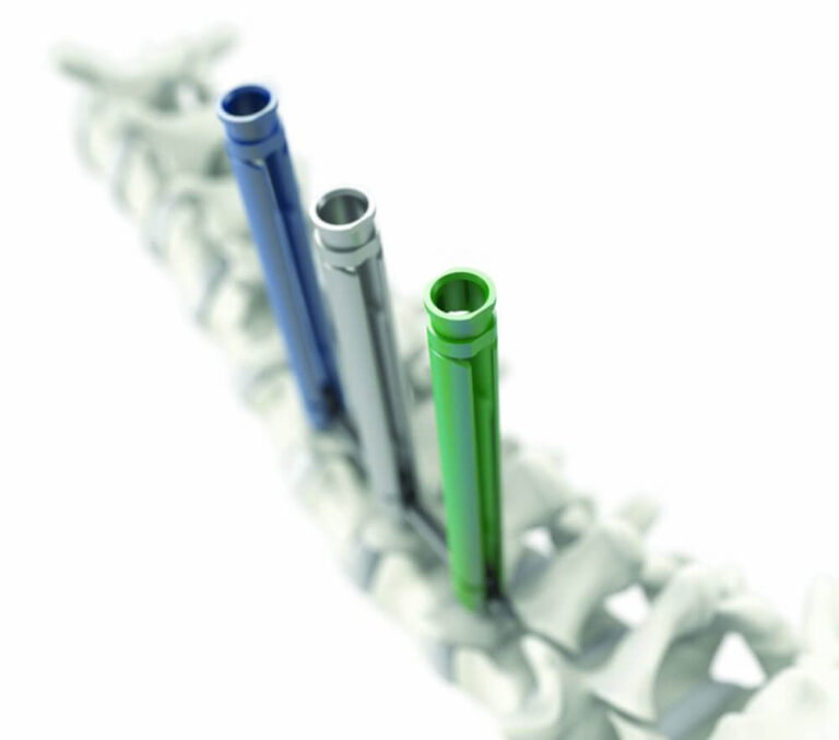 Streamline® MIS – MIS Spinal Fixation System